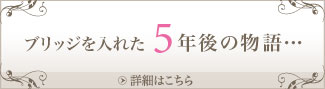 インプラント 東京 の 府中予防インプラントセクション：ブリッジを入れた5年後の物語