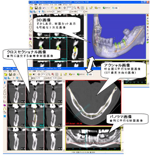 インプラント 東京 の 府中予防インプラントセクション：