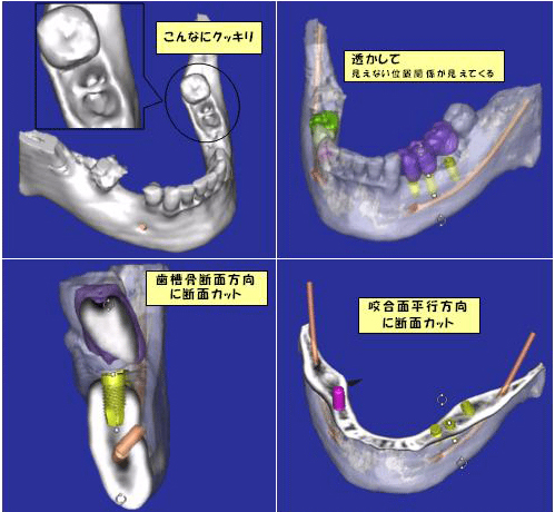 インプラント 東京 の 府中予防インプラントセクション：